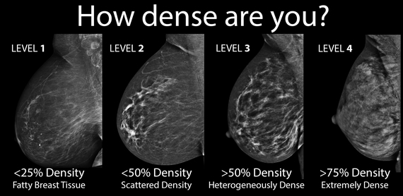 What Is Dense Breast Tissue Feel Like